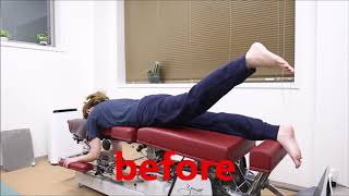飯田橋・猫背矯正（姿勢矯正）用のベッドを使った施術風景