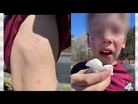 Dangerous social media trend: Police warning public of new ‘Orbeez challenge’