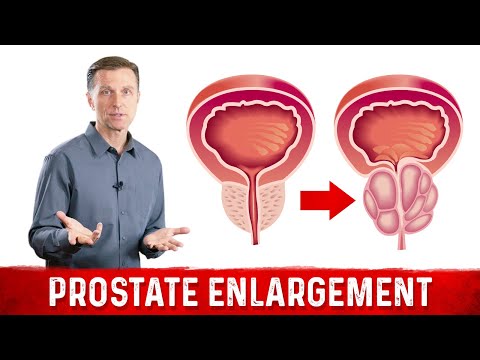 The Real Cause of Prostate Enlargement – Dr.Berg