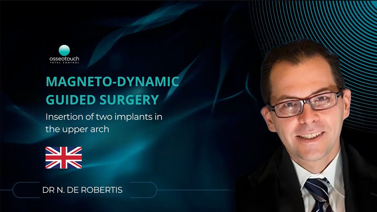 Magnetodynamic guided surgery — placement of two implants in the upper arch