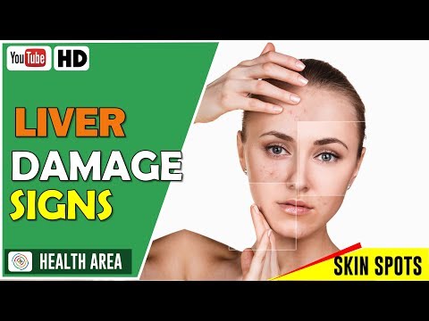 6 Early Symptoms of Liver Damage Don't Ignore These Video