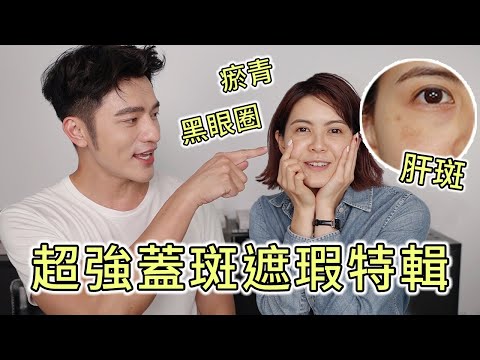 眼下斑