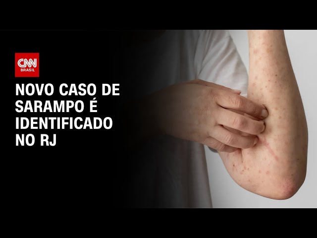 Novo caso de sarampo é identificado no Rio de Janeiro | BASTIDORES CNN
