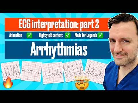 , title : 'Arrhythmias: A Visual Guide with ECG Criteria #ecgmadeeasy'