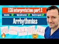 Arrhythmias: A Visual Guide with ECG Criteria #ecgmadeeasy