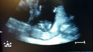 Clap your hands, baby announcement.
