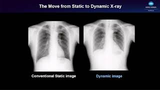 DDR for Pediatrics with Clinical Use Cases