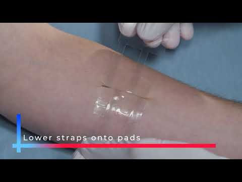 How to Apply Clozex Closures