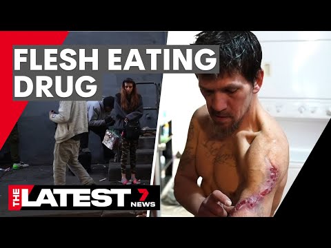 The flesh-eating drug taking over America | 7NEWS