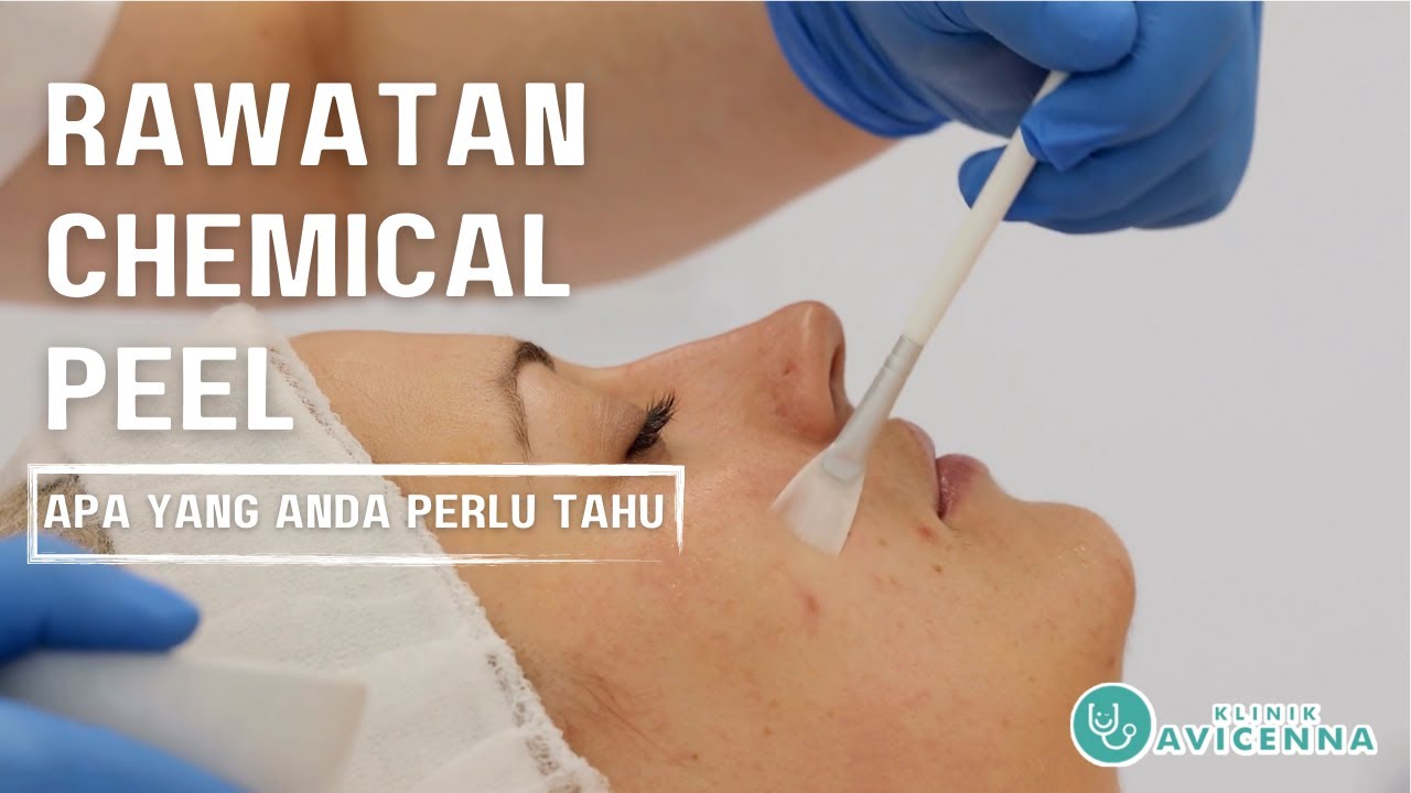Kenapa Anda Perlukan Rawatan Chemical Peel