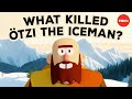 A 5 300 Year Old Murder Mystery Albert Zink
