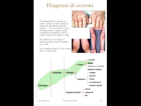 Eczema e gravidanze Eczemi su giunture