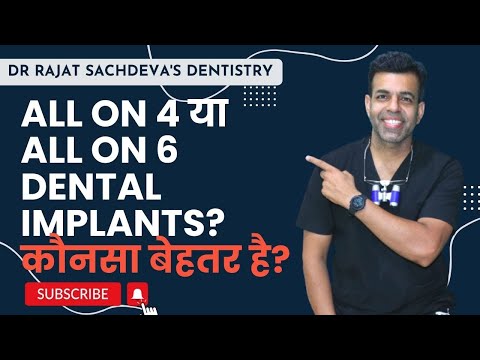 Which is better All-on-4 or All-on-6 dental implants procedure? Hybrid Prosthesis vs. Implant Bridge