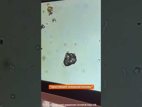 А вы знаете, что живет в луже у вашего дома? 