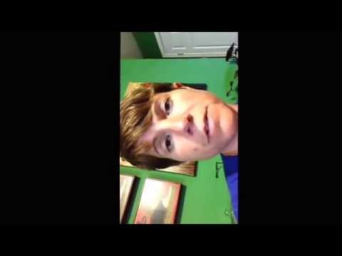 Sacroiliac I fuse surgery after gastric bypass