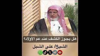 صورة أ.د. علي الشبل | هل يجوز الكشف عند عم الأولاد
