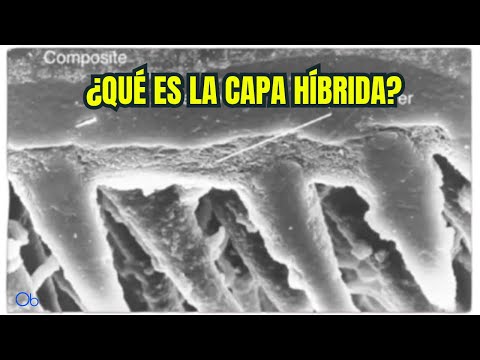 ¿Qué es la Capa Híbrida? 🦷