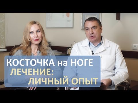 Как лечить косточку на большом пальце ноги – личный опыт. Подагра ли это? Нужно ли делать операцию.