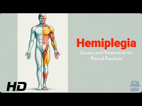 Hemiplegia 101: Identifying Causes and Exploring Effective Therapies
