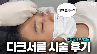 다크서클 때문에 고민이신 분 집중!