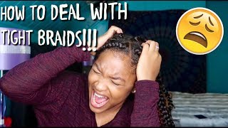 HOW TO| DEAL WITH TIGHT BRAIDS