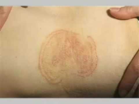 Mal di schiena nella donazione basso addome Accessori per giunti