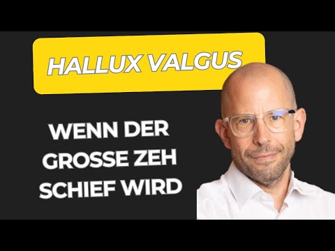 Hallux valgus – When the big toe becomes crooked