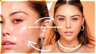How To Conceal Inflamed Acne in 4 Steps | Roxette Arisa