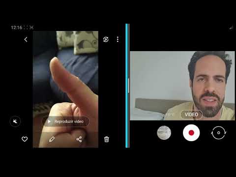 Dedo em Gatilho - Cirurgia ou Fisioterapia?