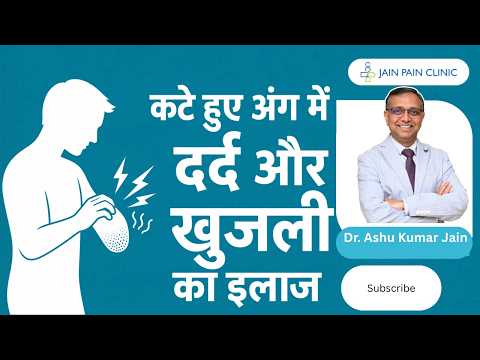 Watch video on phantom limb pain treatment