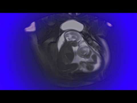 dreamies® Illegal Aliens