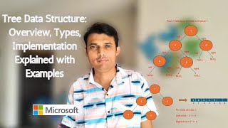 Tree Data Structure | Overview | Types of Trees | Implementation | Use cases with Examples