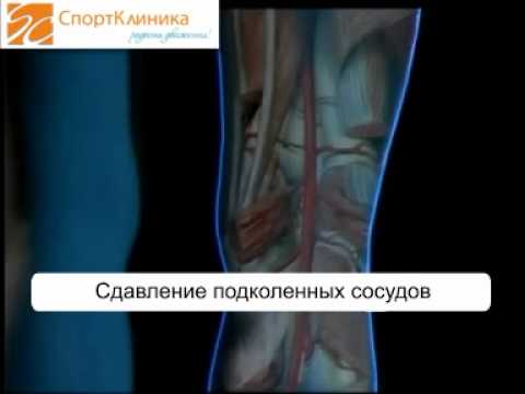 Размеры суставов у детей Боли в пояснице при поднятие тяжести
