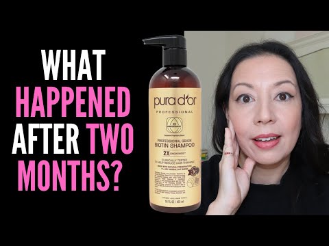 HAIR LOSS SUFFERER TESTS PURA D'OR PROFESSIONAL BIOTIN...