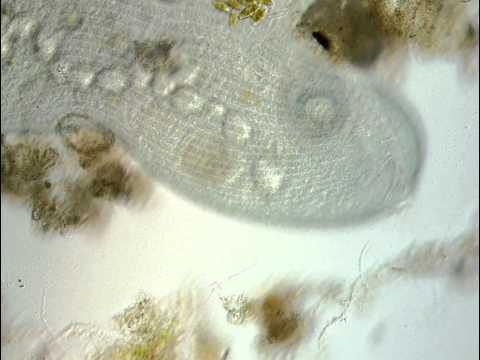 Stentor, the Incredible Protist_P1_Movie 633