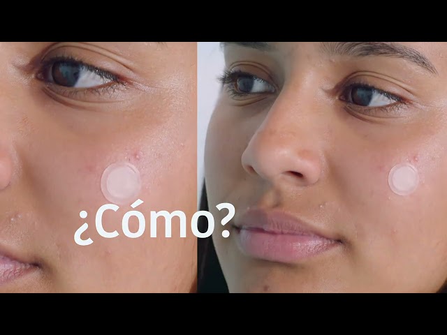 Vídeo relacionado con IROHA NATURE - Mascarilla Anti-Imperfecciones | Cosmética Coreana Seborreguladora | Con Ácido Salicílico, Niacinamida y Cica | Para Piel Mixta a Grasa | Previene y reduce los granos