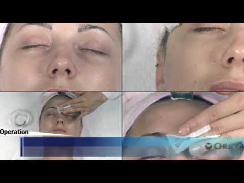 download lagu mp3 mp4 Mesolex, download lagu Mesolex gratis, unduh video klip Mesolex