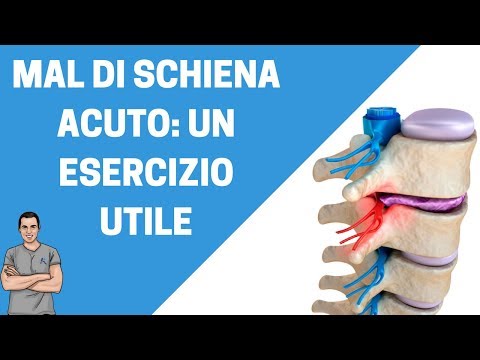 Sclerosi subcondrale delle articolazioni della spalla Rimuovere il dolore farmaci