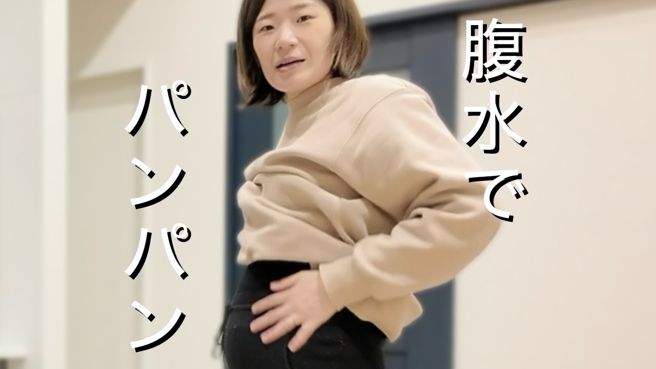 【2人目不妊治療】なかなか良くならないOHSS