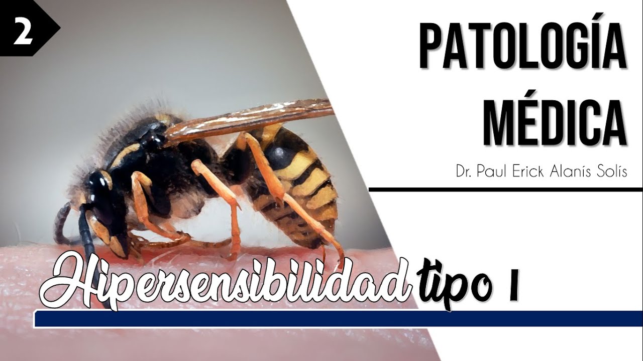Hipersensibilidad tipo I