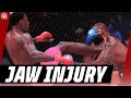Harmful Jaw Injury by Phil Davis! | Bellator MMA