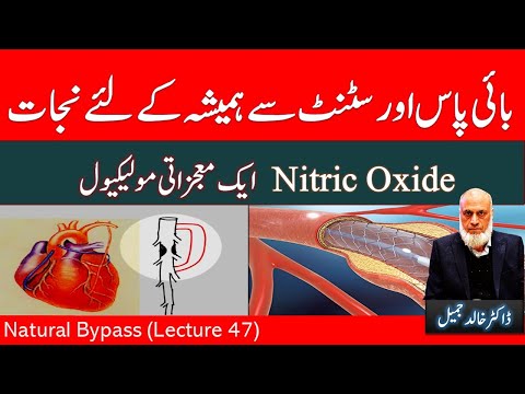 Heart Health - سٹنٹ اور بائی پاس سے مکمل نجات  | Lecture 47