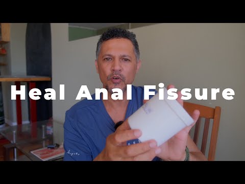 This will Cure your Anal Fissure.