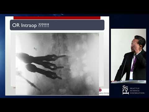 MIS Navigation Case Presentation - Terrence T. Kim, MD