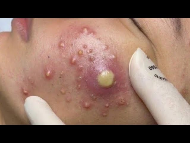 𝑺𝒐𝒐𝒕𝒉𝒊𝒏𝒈 𝑭𝒂𝒄𝒊𝒂𝒍 𝑻𝒓𝒆𝒂𝒕𝒎𝒆𝒏𝒕 𝑭𝒐𝒓 𝑺𝒕𝒓𝒆𝒔𝒔 𝑹𝒆𝒍𝒊𝒆𝒇 𝒂𝒕 𝑳𝒖𝒙𝒖𝒓𝒚 𝑺𝒑𝒂 𝑨𝒄𝒉𝒊𝒆𝒗𝒆 𝑰𝒏𝒏𝒆𝒓 𝑷𝒆𝒂𝒄𝒆 