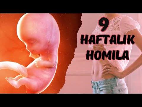 9 HAFTALIK (3 OYLIK) HOMILA RIVOJLANISHI.