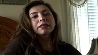 Rhinoplasty Advice from an Actual Patient