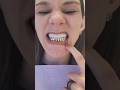 Custom GOLD #teeth & Dental implants  @jaximplantsanddentures 🌟 #gold #dentalimplants #dentist