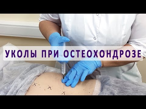 Недозрелость сустава Болит поясница это роды