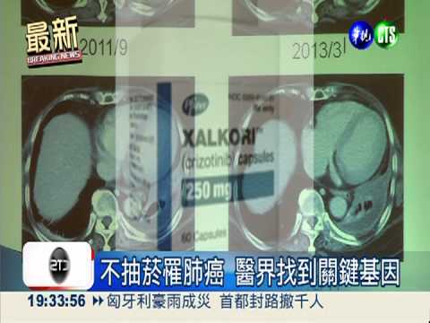 肺癌年殺8千人! 關鍵基因"惡客"